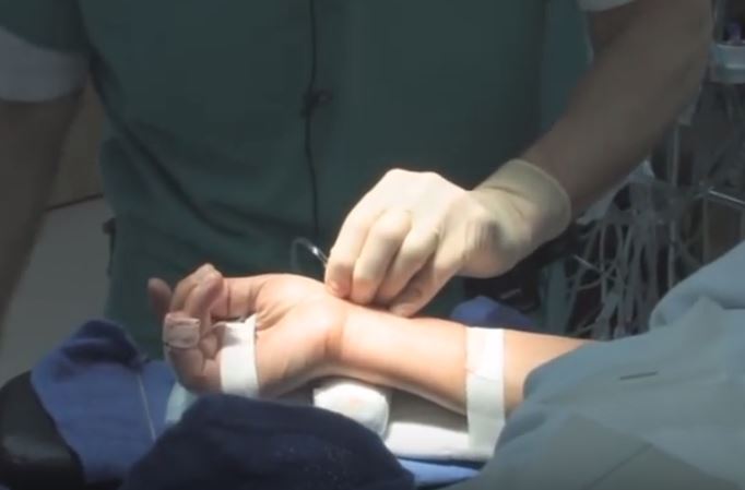 doctor_michael_jonas_israel_radial_artery_catheterization_advantages