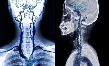 page A4 Eng.pdf – 1